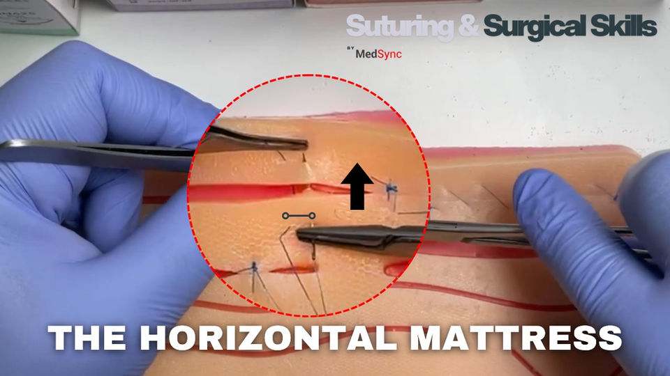 Horizontal Mattress Suture